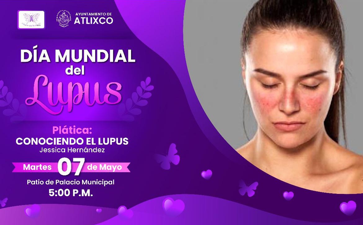 Ayuntamiento de Atlixco, invita a conmemorar el día internacional del lupus